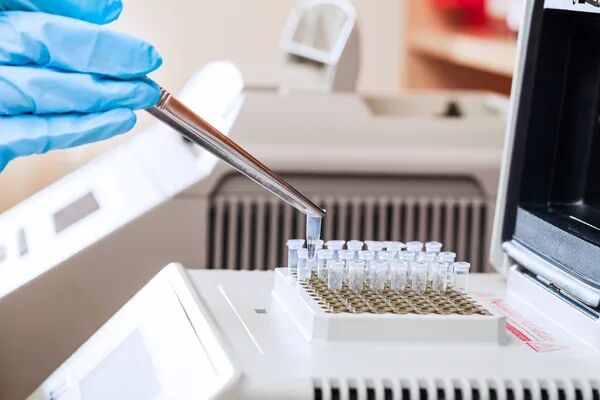 Laboratory Tweezers: The Key to Precision and Safety