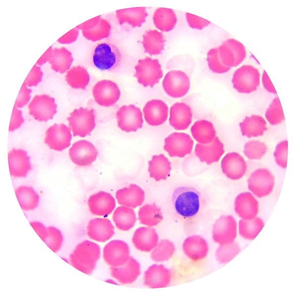 Hazır Mikroskop Slaytı - Daimi Kan Preparatı - İnsan Kanı