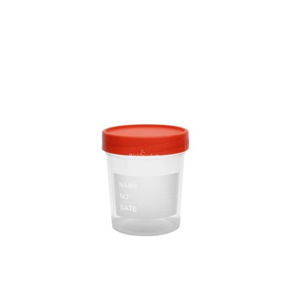 İdrar Numune Kabı 100ml - Aseptik Steril Beher 100 Adet