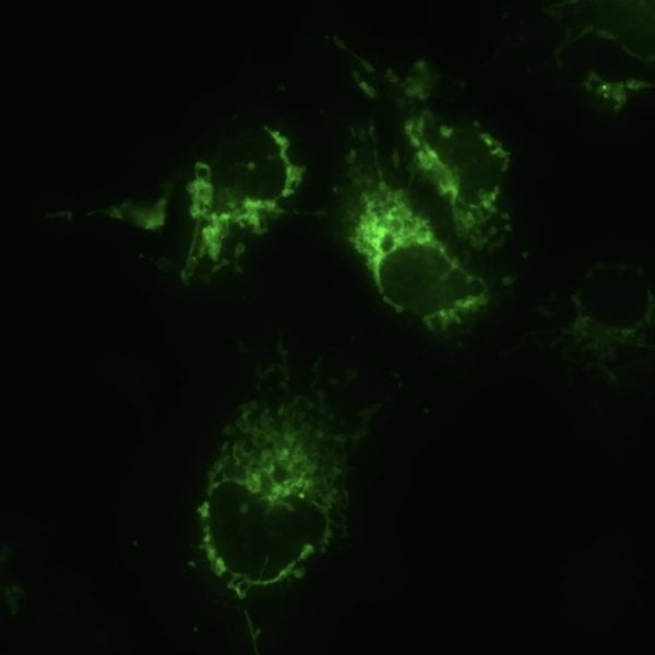 OPTIKA B-293LD1 Trinoküler Floresan Mikroskop IOS Sistem - Araştırma Mikroskobu 1000x